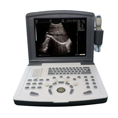 Escaneador de ultrassom de diagnóstico digital completo portátil OEM