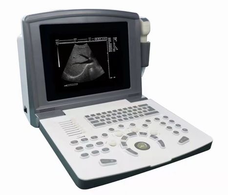 Escaneador de ultrassom de diagnóstico digital completo portátil OEM