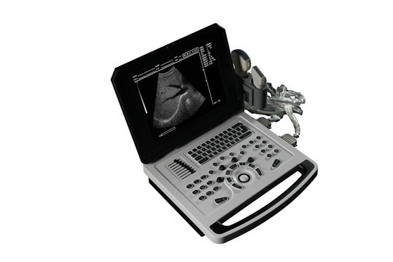 Notebook Ultra-som preto e branco para cardiologia