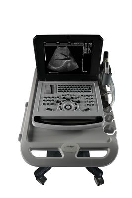 Notebook Ultra-som preto e branco para cardiologia