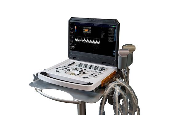 CE Portátil Color Doppler máquina de ultra-som scanner OEM